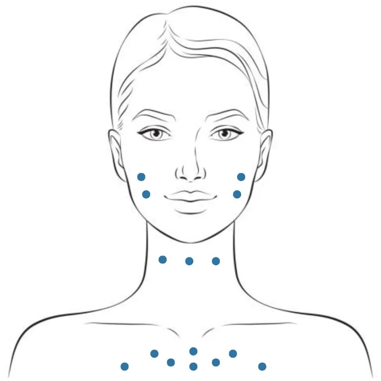 GLODERM 12L treatment areas