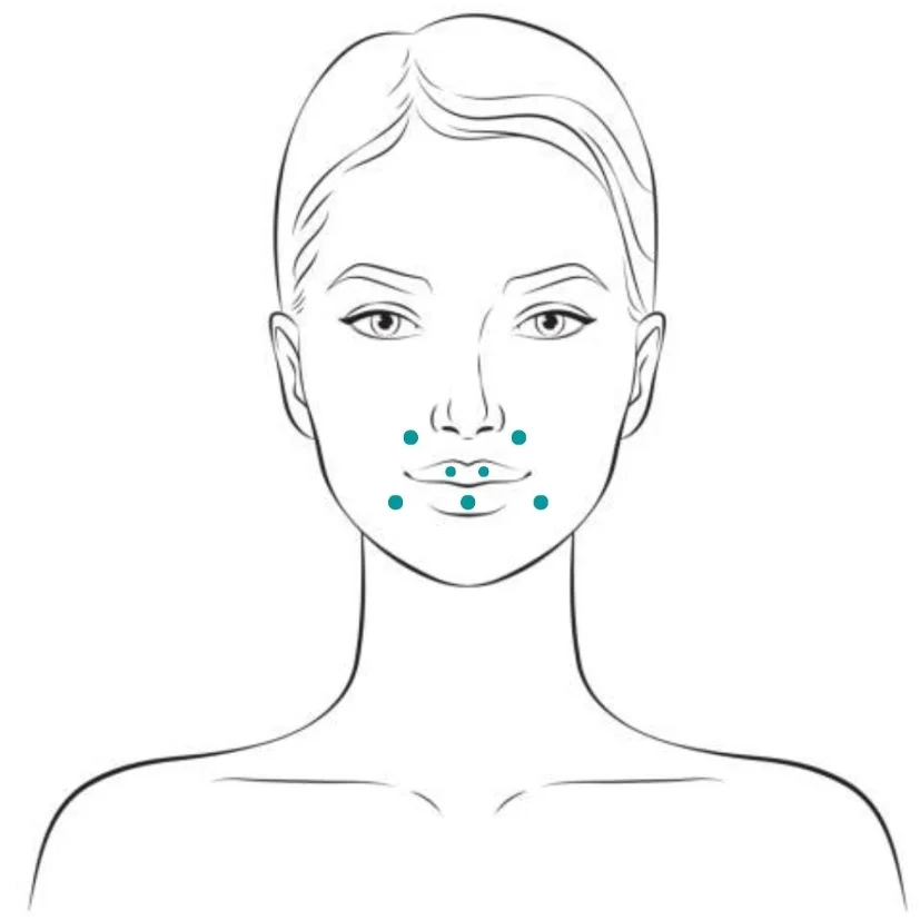 GLODERM 24L treatment areas